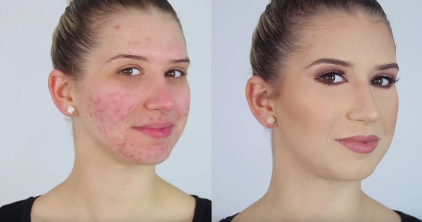 Before & After